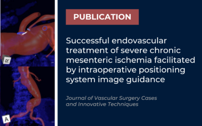 Journal of Vascular Surgery: Successful endovascular treatment of severe chronic mesenteric ischemia facilitated with IOPS