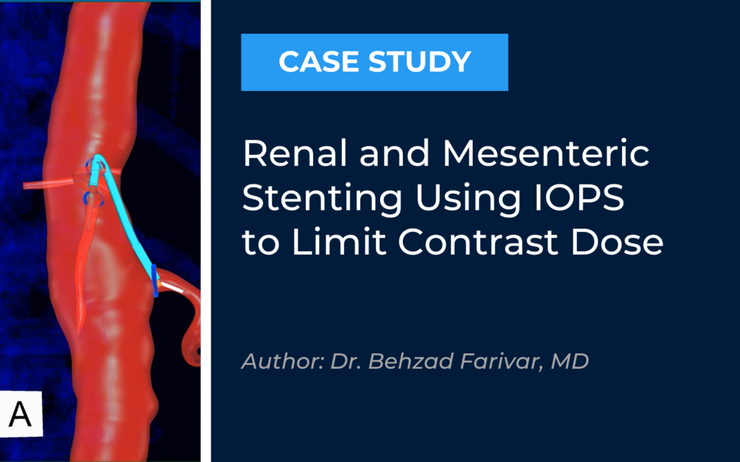 Renal and Mesenteric Stenting Using IOPS to Limit Contrast Dose