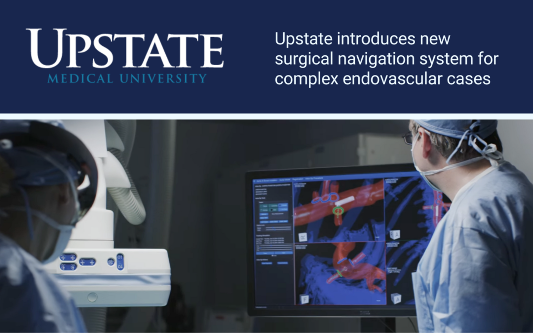 Upstate introduces new surgical navigation system for complex endovascular cases