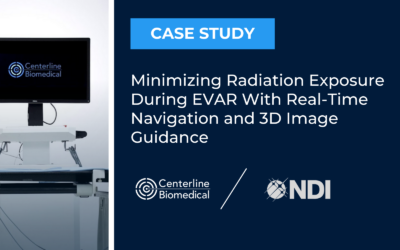 Minimizing Radiation Exposure During EVAR With Real-Time Navigation