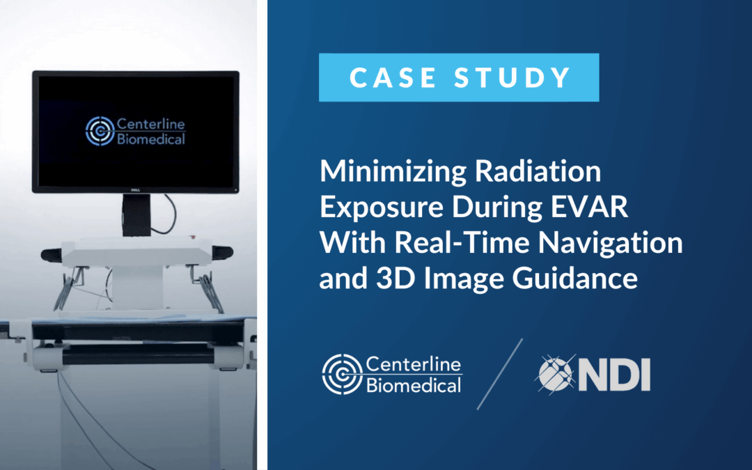 Minimizing Radiation Exposure During EVAR With Real-Time Navigation